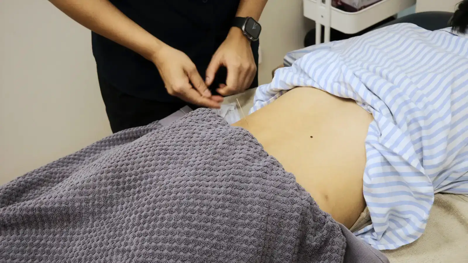 Fine needles inserted into trigger points during a dry needling treatment at Pro Health Clinic