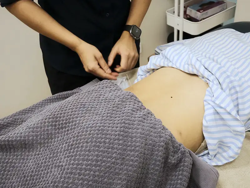 Practitioner placing a fine needle into the lower back